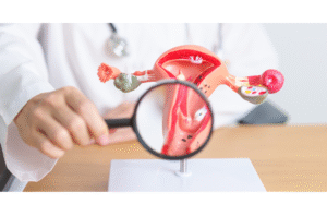 The Cost of NOT Treating Severe Endometriosis Surgically